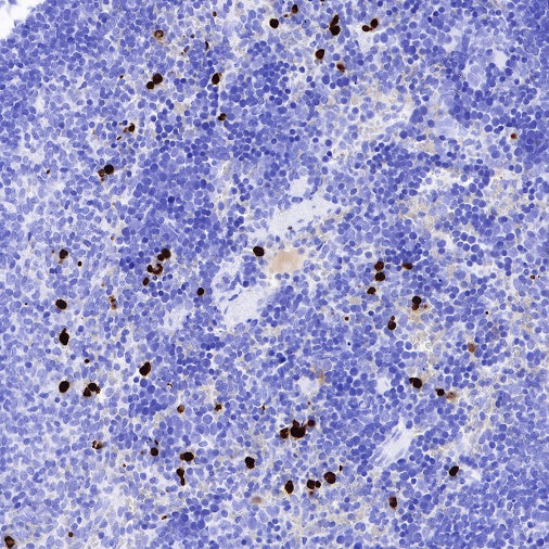 S100A8/MRP8 Recombinant Rabbit mAb (S-R251)
