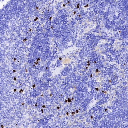 S100A8/MRP8 Recombinant Rabbit mAb (S-R251)