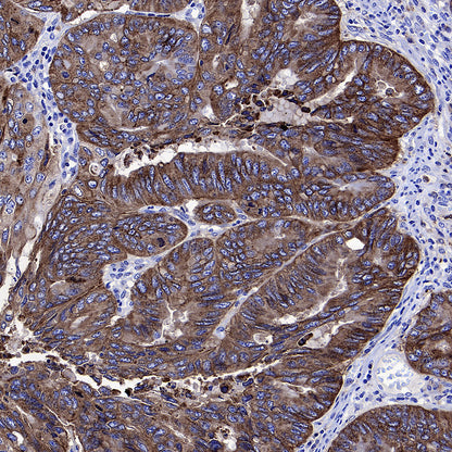 Transferrin Receptor Recombinant Rabbit mAb (S-4791)