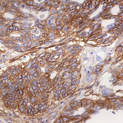 B7-H3 Recombinant Rabbit mAb (SDT-249-26)