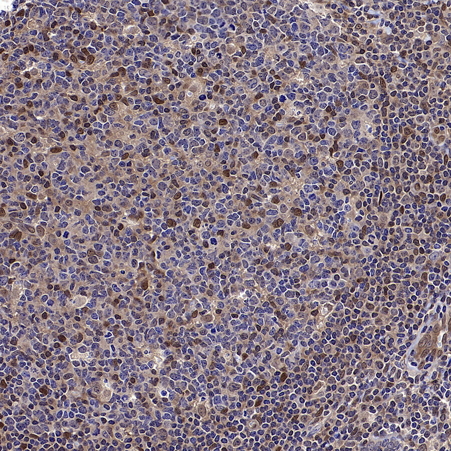DCAF8 Recombinant Rabbit mAb (S-3483-11)