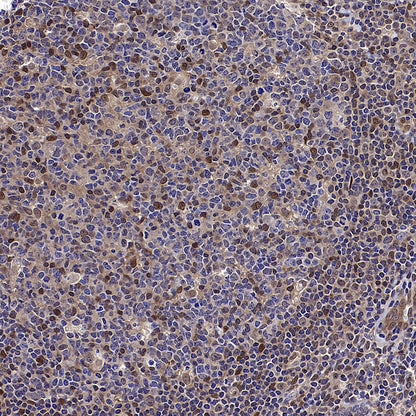 DCAF8 Recombinant Rabbit mAb (S-3483-11)