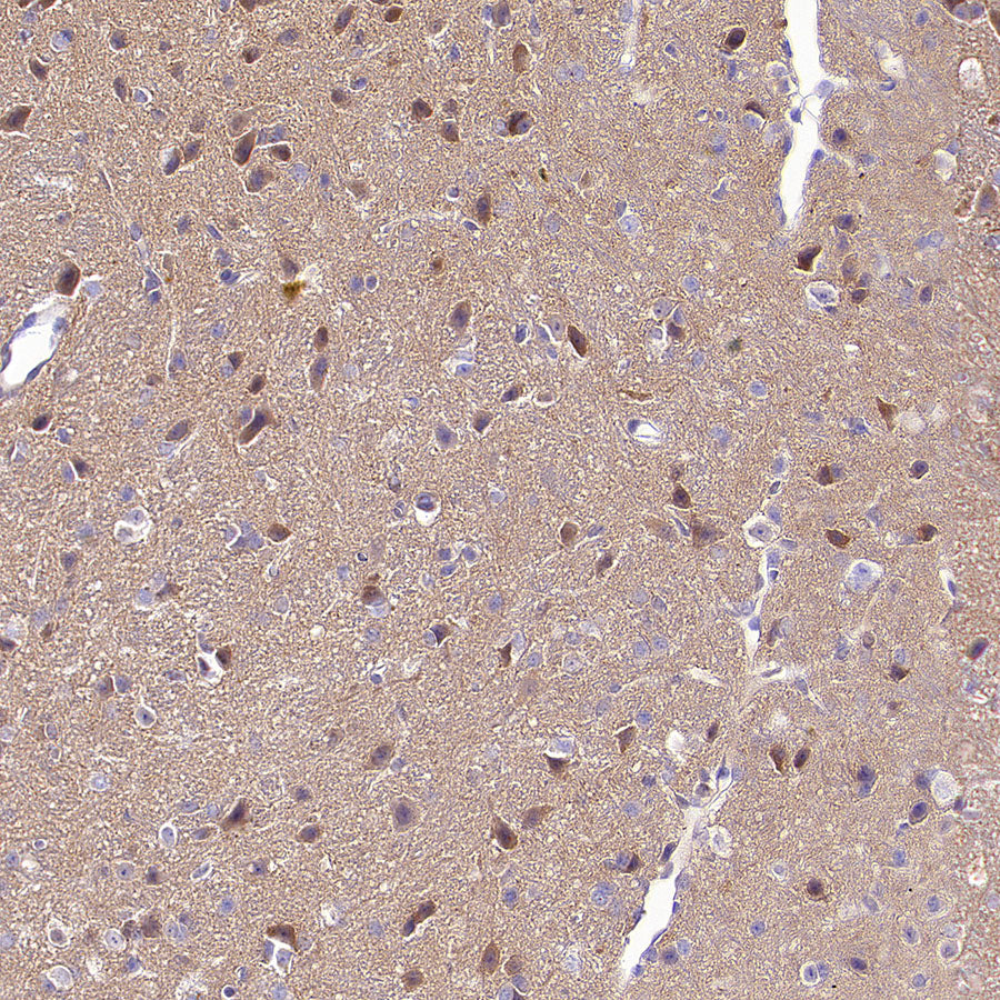 TORC1/CRTC1 Recombinant Rabbit mAb (S-3978-42)