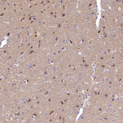 TORC1/CRTC1 Recombinant Rabbit mAb (S-3978-42)