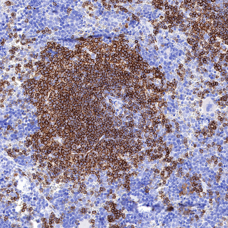 S-RMab® CD20 Recombinant Rabbit mAb,PBS Only (SDT-R133)
