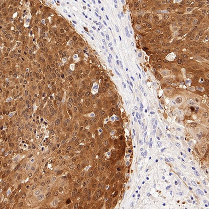 CDKN2A/p16 INK4A Recombinant Mouse mAb (SDT-4677)
