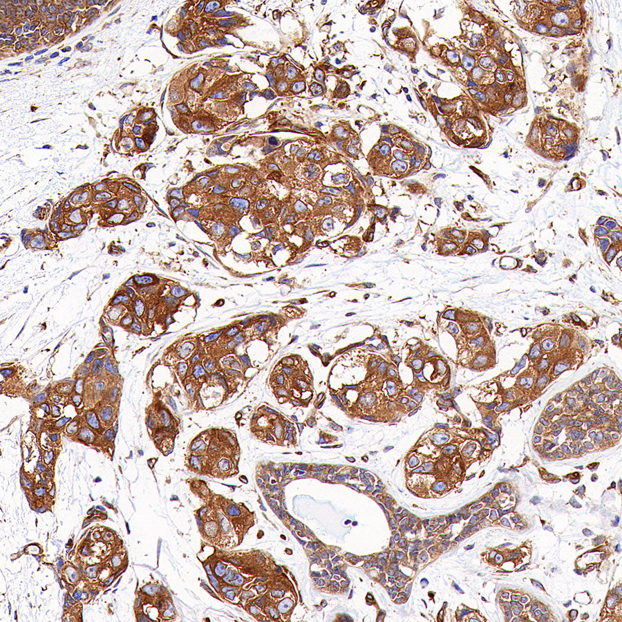 KLC1 Recombinant Rabbit mAb (S-4556-8)