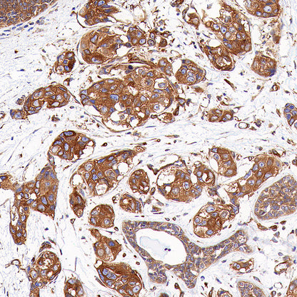 KLC1 Recombinant Rabbit mAb (S-4556-8)