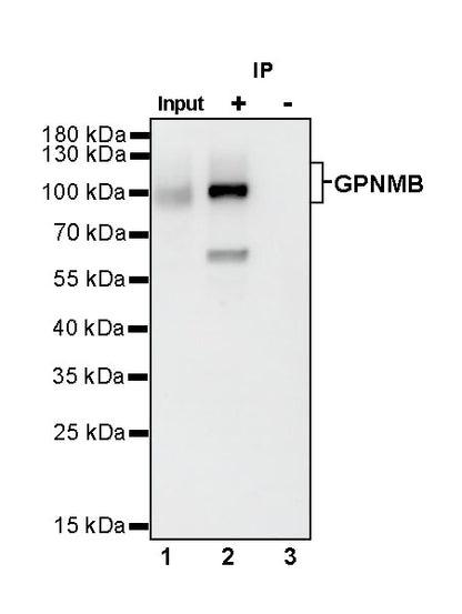 GPNMB Recombinant Rabbit mAb (S-R241)
