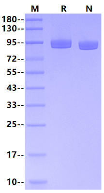 APLP2/Amyloid-like protein 2 His Tag Protein, Human