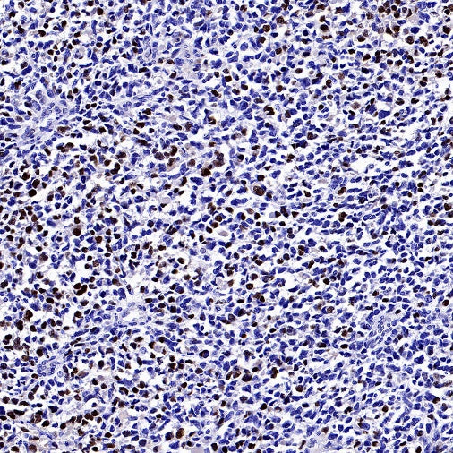 Myogenin Recombinant Rabbit mAb (SDT-3351)