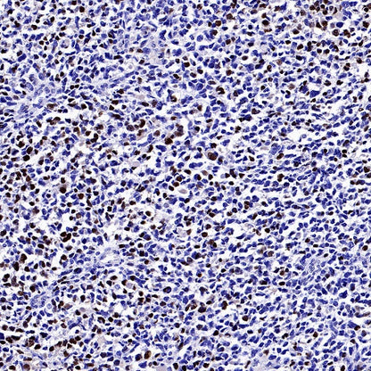 Myogenin Recombinant Rabbit mAb (SDT-3351)