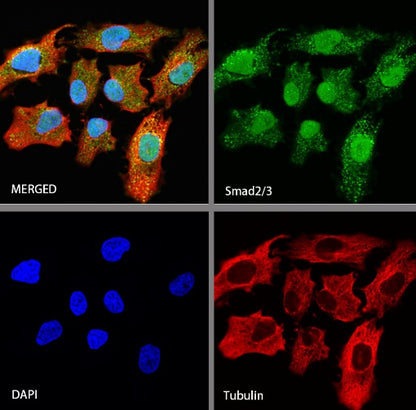 SMAD2 Rabbit Polyclonal Antibody