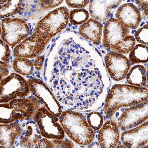 NDUFA1 Recombinant Rabbit mAb (S-1277-177)