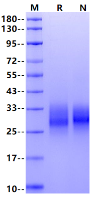 4-1BB/TNFRSF9 His Tag Protein, Human