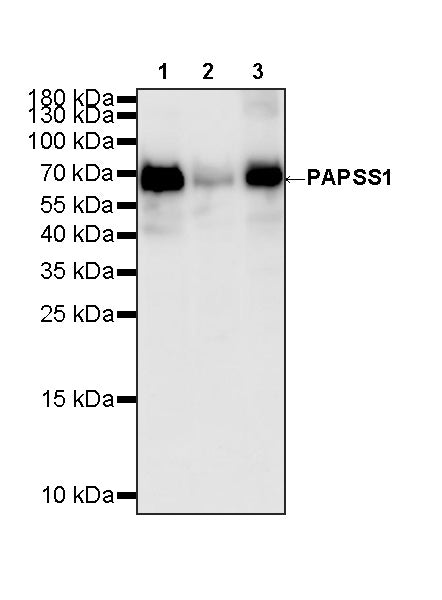 PAPSS1 Recombinant Rabbit mAb (S-3516-23)