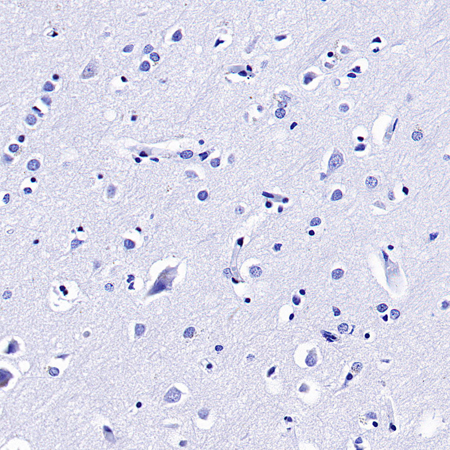 SOX2 Recombinant Rabbit mAb (S-5000)