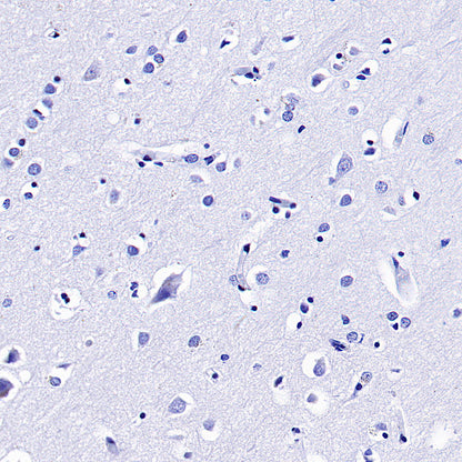 SOX2 Recombinant Rabbit mAb (S-5000)
