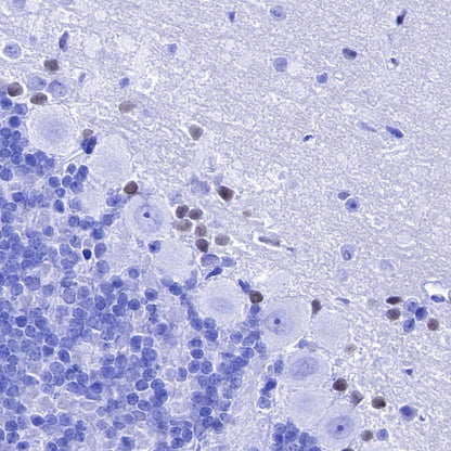 SOX1 Recombinant Rabbit mAb (S-R310)