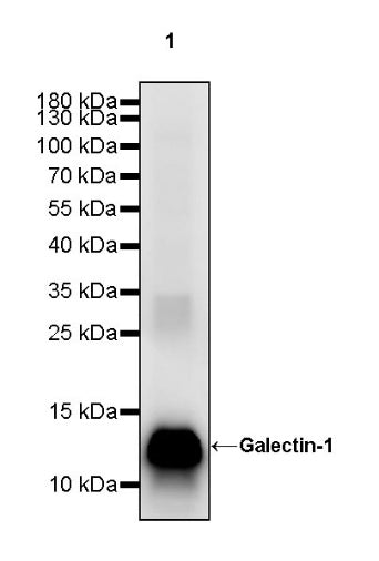 Galectin-1 Recombinant Rabbit mAb (S-1221-32）