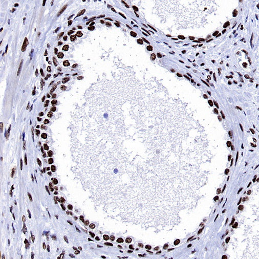 ARID1A Recombinant Rabbit mAb (S-440-62)