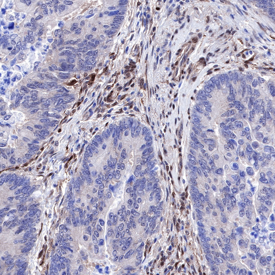 PTEN Recombinant Rabbit mAb (SDT-R074)