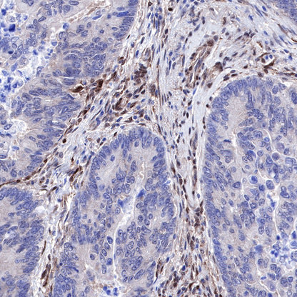 PTEN Recombinant Rabbit mAb (SDT-R074)