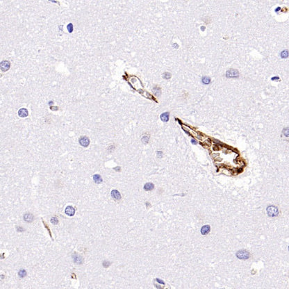 LPA Rabbit Polyclonal Antibody