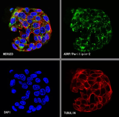ADRP/Perilipin-2 Recombinant Rabbit mAb (S-2210-3)