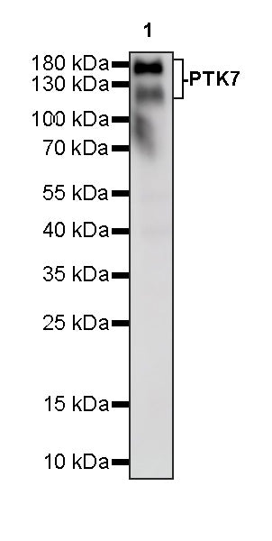 PTK7 Recombinant Rabbit mAb (SDT-2432-136)