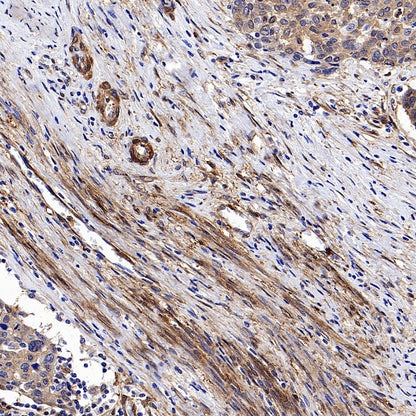 Vinculin Recombinant Rabbit mAb (S-1635-3)
