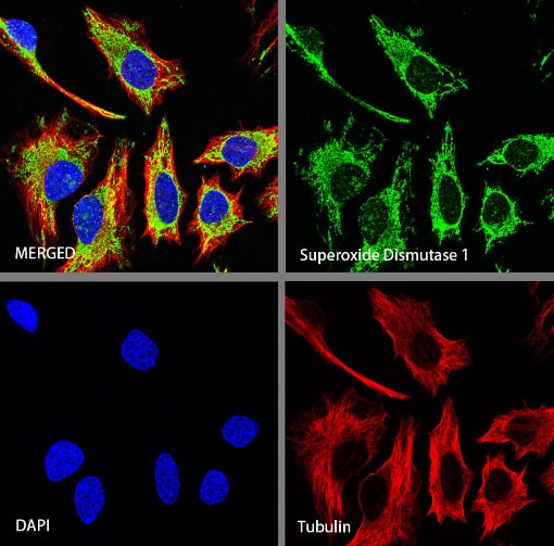 Superoxide Dismutase 1 Recombinant Rabbit mAb (S-1537-39)