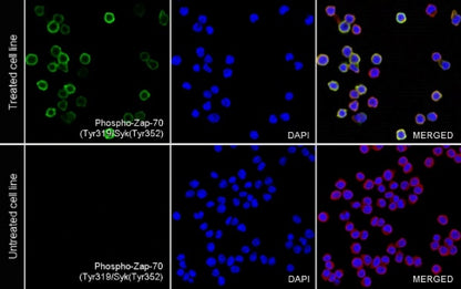 Phospho- Zap-70 (Tyr319)/Syk (Tyr352) Recombinant Rabbit mAb (S-1252-12)