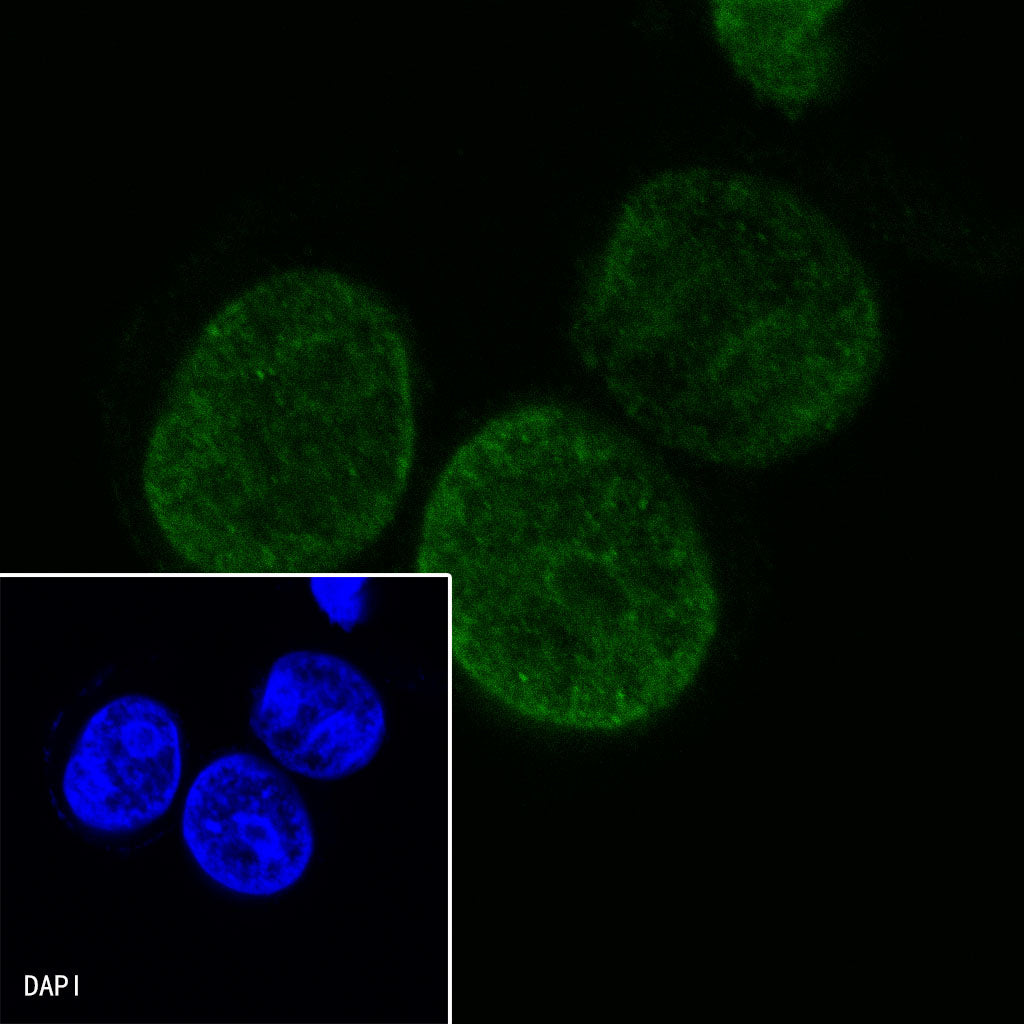 S-RMab®SALL4 Recombinant Rabbit mAb (SDT-R232)