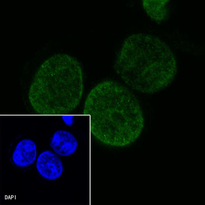 S-RMab®SALL4 Recombinant Rabbit mAb (SDT-R232)