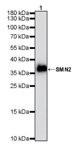 SMN2 Recombinant Rabbit mAb (S-4920-4)