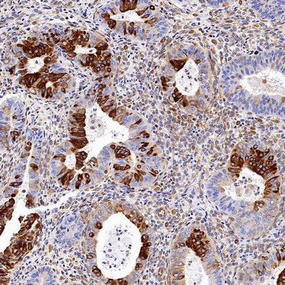 STING Recombinant Rabbit mAb (S-1392-33)