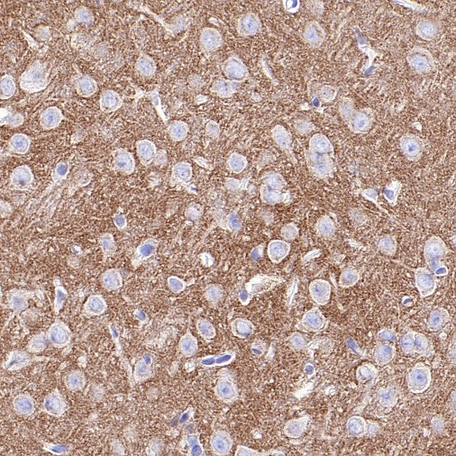 Pan Trk Recombinant Rabbit mAb (SDT-400-39)