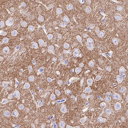 Pan Trk Recombinant Rabbit mAb (SDT-400-39)