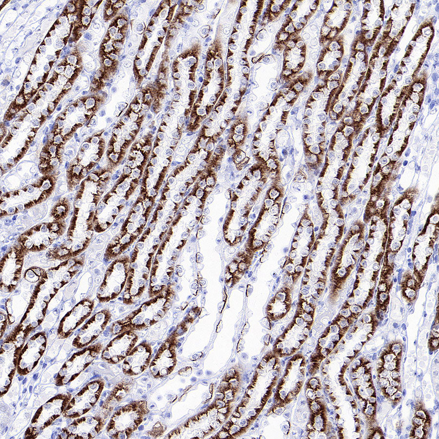 BSND Recombinant Rabbit mAb (S-3815-70)