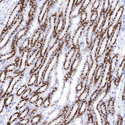 BSND Recombinant Rabbit mAb (S-3815-70)
