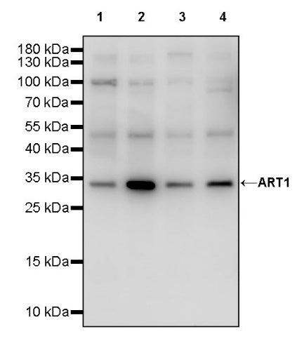 ART1 Recombinant Rabbit mAb (S-2396-1)