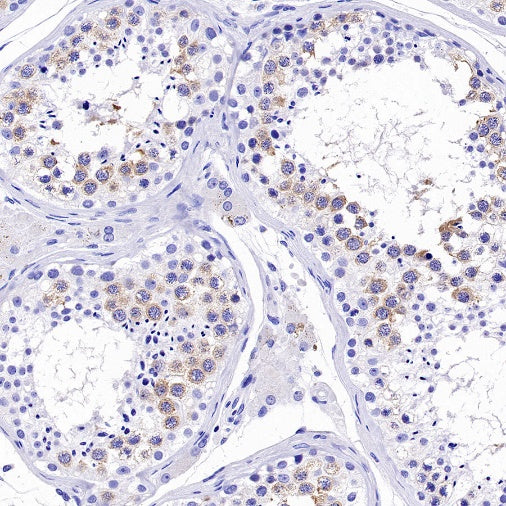 DAZL Rabbit Polyclonal Antibody