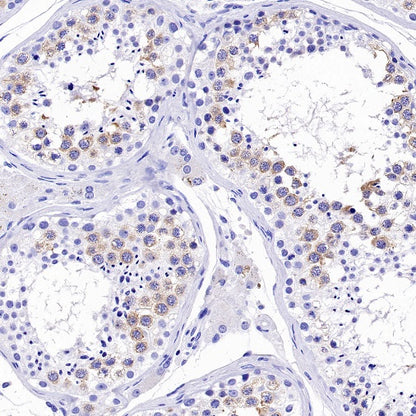 DAZL Rabbit Polyclonal Antibody