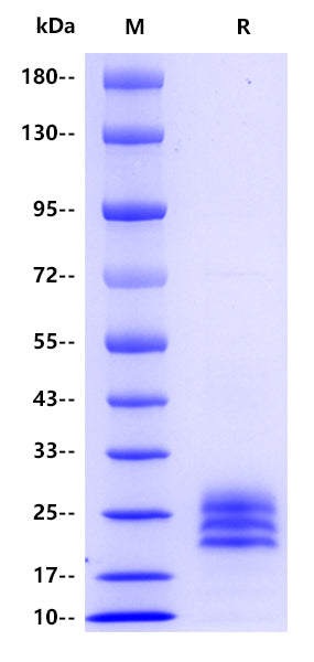 IL-25 His Tag Protein, Human
