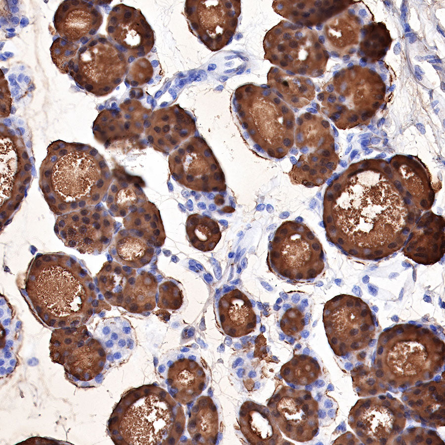 Thyroglobulin Recombinant Rabbit mAb (SDT-209-297)