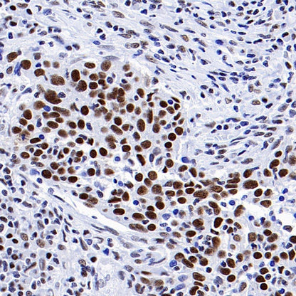 CDK9 Rabbit Polyclonal Antibody