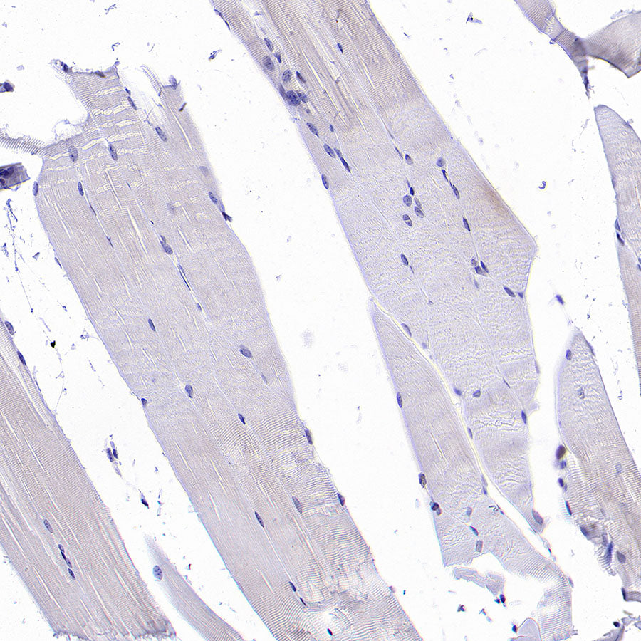 ATAD2 Recombinant Rabbit mAb (S-4145-63)