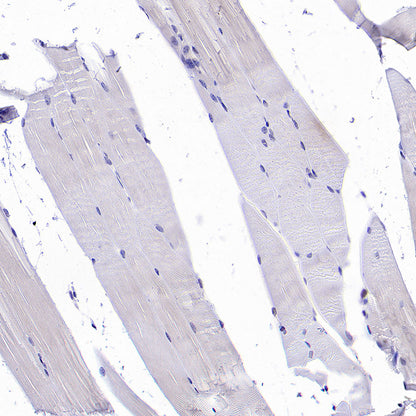 ATAD2 Recombinant Rabbit mAb (S-4145-63)