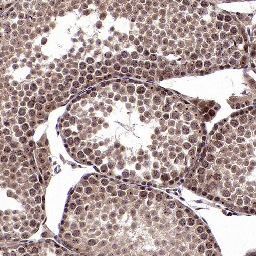 cIAP2 Recombinant Rabbit mAb (S-2483-8)